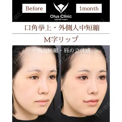 Otus Clinic 【オータスクリニック】 中 徳太郎医師の症例