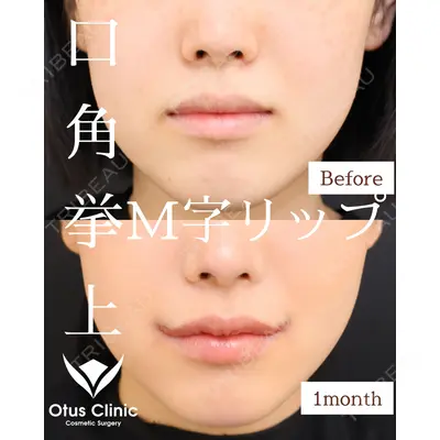 Otus Clinic 【オータスクリニック】 中 徳太郎医師の症例