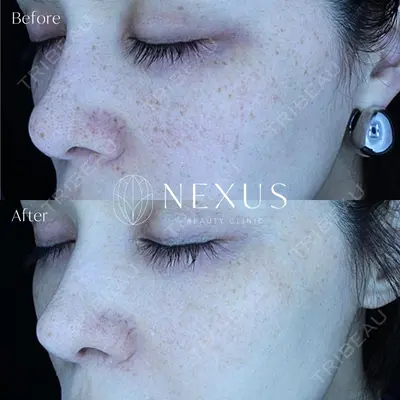 NEXUS CLINIC 酒井　知子医師の症例