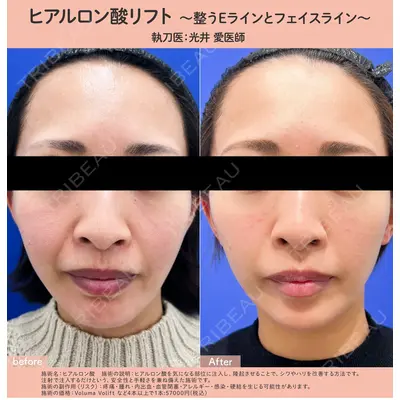湘南美容クリニック 浜松院の症例
