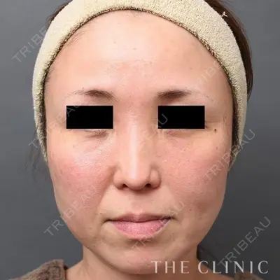 THE CLINIC（ザ・クリニック） 東京院の症例