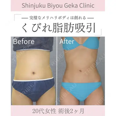 新宿美容外科クリニック 新宿院 井上 淳医師の症例
