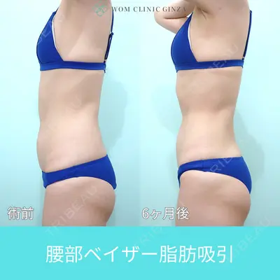 WOM CLINIC GINZA （ワム クリニック ギンザ） 佐々木 和司医師の症例