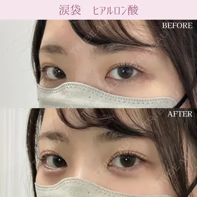 ルラ美容クリニック銀座院 山本 泰輔医師の症例