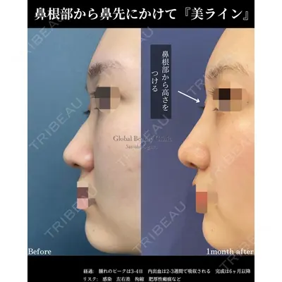 グローバルビューティークリニック 東京院の症例