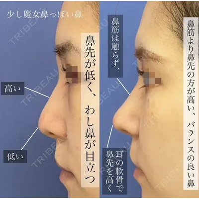 グローバルビューティークリニック 銀座院 理事長　杉崎　裕斗医師の症例