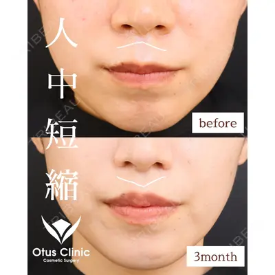 Otus Clinic 【オータスクリニック】 中 徳太郎医師の症例