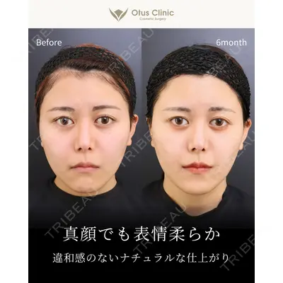Otus Clinic 【オータスクリニック】 中 徳太郎医師の症例