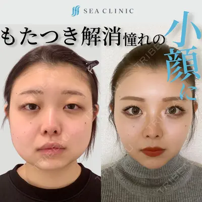SEA CLINIC（シークリニック） 沼澤 茂医師の症例