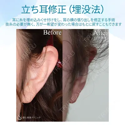 聖心美容クリニック 六本木院 菱田 健作医師の症例