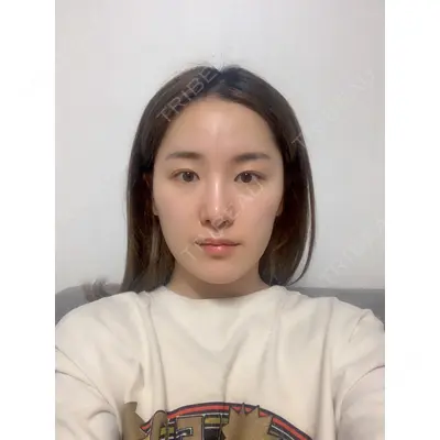 TL美容整形外科 顔面輪郭・目・鼻センター チェ・セウン医師の症例