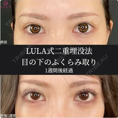 ルラ美容クリニック 大阪心斎橋院 藤川 一朗医師の症例