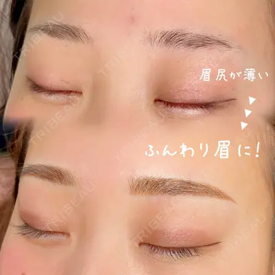 LEAGRANT CLINIC 中目黒 中村 未咲医師の症例