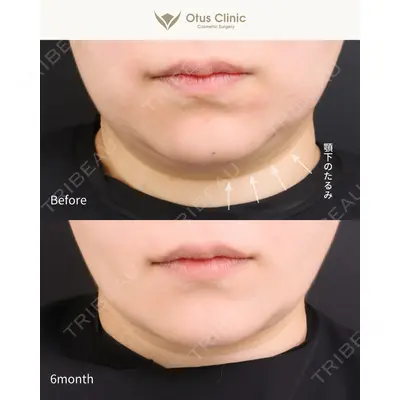 Otus Clinic 【オータスクリニック】 中 徳太郎医師の症例