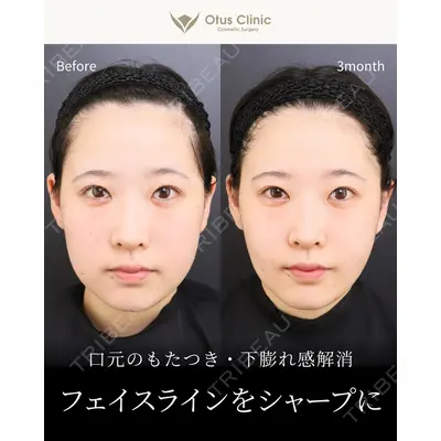 Otus Clinic 【オータスクリニック】 中 徳太郎医師の症例