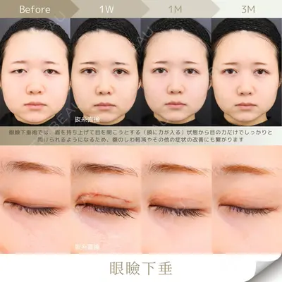 Otus Clinic 【オータスクリニック】 中 徳太郎医師の症例