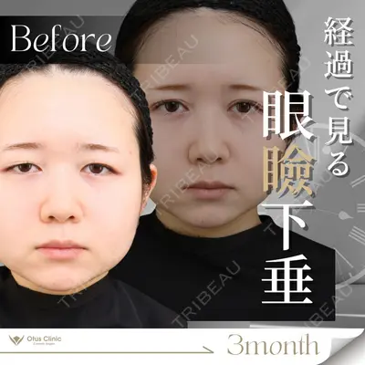 Otus Clinic 【オータスクリニック】 中 徳太郎医師の症例