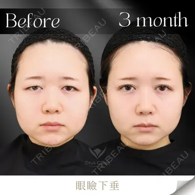 Otus Clinic 【オータスクリニック】 中 徳太郎医師の症例