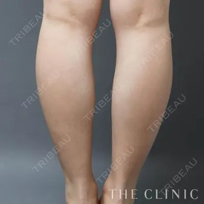 THE CLINIC（ザ・クリニック） 東京院 大橋 昌敬医師の症例