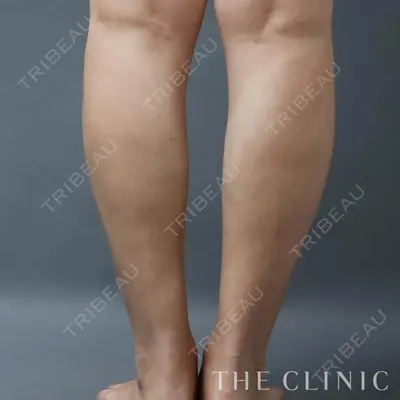 THE CLINIC（ザ・クリニック） 東京院 大橋 昌敬医師の症例