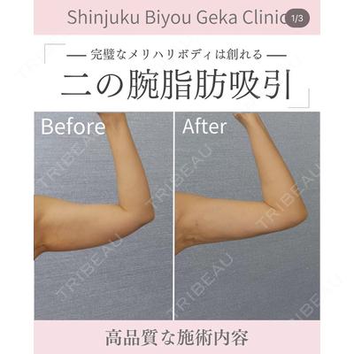 新宿美容外科クリニック 新宿院 井上 淳医師の症例