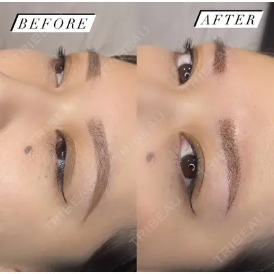 Tokyo Tensei Clinic 新宿院 斉藤美優医師の症例