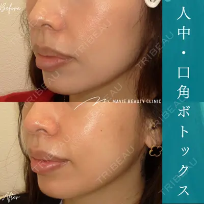 Mavie Beauty Clinic （マヴィービューティークリニック） 渡邉 憲一郎医師の症例