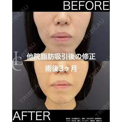 LIBER CLINIC 矢橋 洋一郎医師の症例