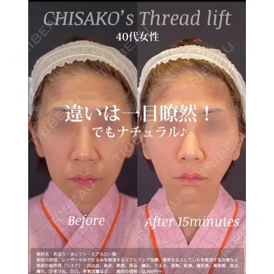 自由が丘ウェルエイジングビューティークリニック 福田 知佐子医師の症例