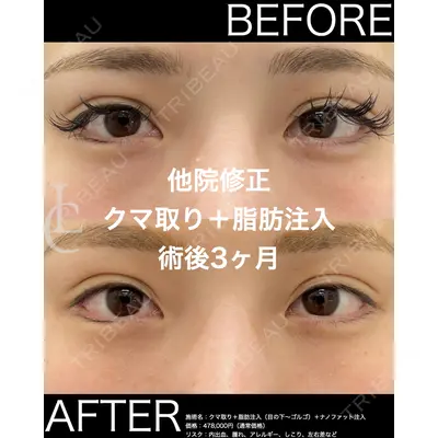 LIBER CLINIC 矢橋 洋一郎医師の症例