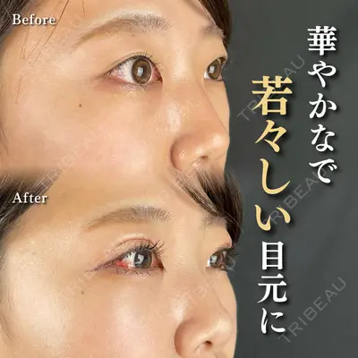 ルラ美容クリニック 新潟院の症例