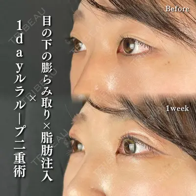 ルラ美容クリニック 新潟院の症例