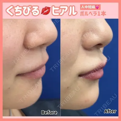 湘南美容クリニック 江坂院の症例