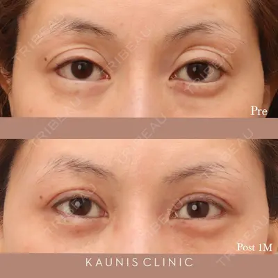 KAUNIS CLINIC（カウニスクリニック） 高野 敏郎医師の症例