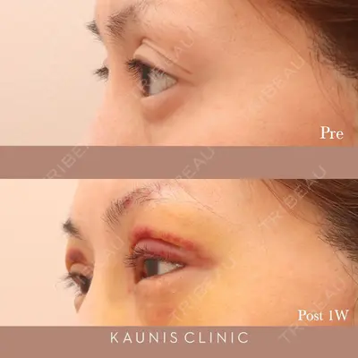 KAUNIS CLINIC（カウニスクリニック） 高野 敏郎医師の症例