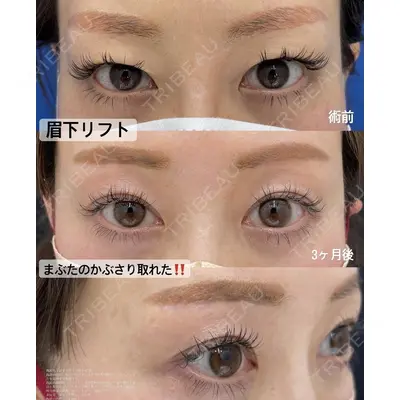 湘南美容クリニック 浜松院の症例