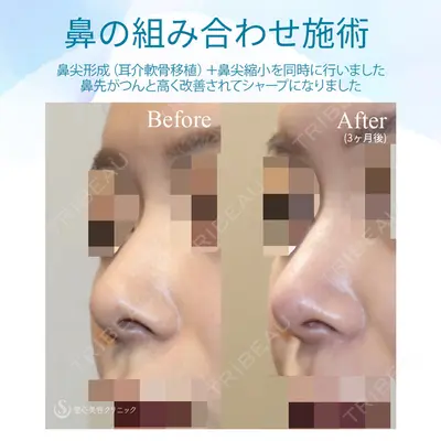 聖心美容クリニック 銀座院 牧野 陽二郎医師の症例