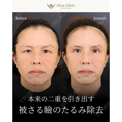 Otus Clinic 【オータスクリニック】 中 徳太郎医師の症例