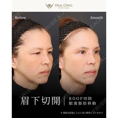 Otus Clinic 【オータスクリニック】 中 徳太郎医師の症例