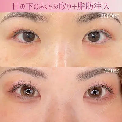 ルラ美容クリニック銀座院 山本 泰輔医師の症例