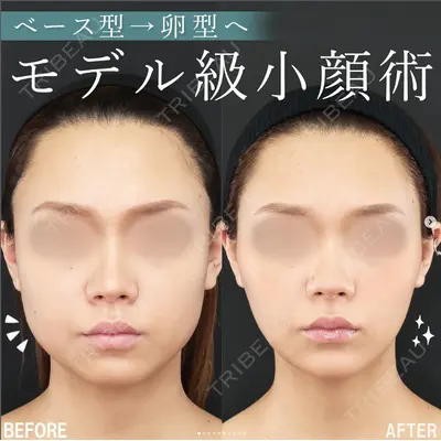 大阪TAクリニックの症例
