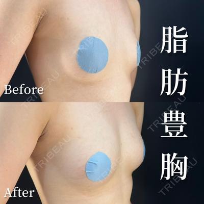 HAAB BEAUTY CLINIC 南青山本院（新院） 金子 雄医師の症例