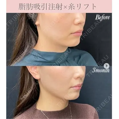 湘南美容クリニック 秋葉原院の症例