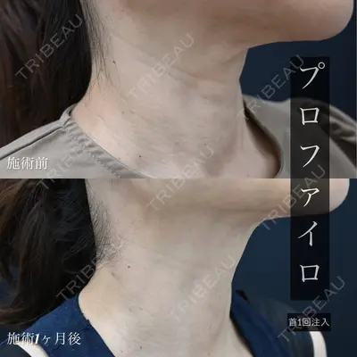 湘南美容クリニック 新橋銀座口院の症例