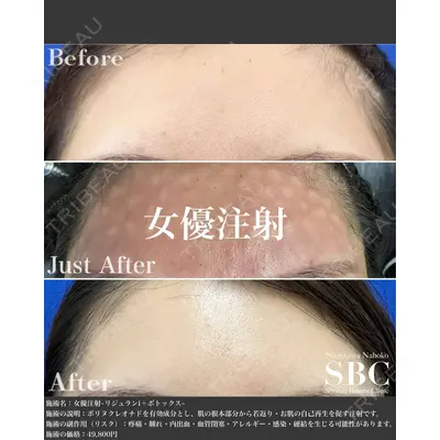 湘南美容クリニック 銀座院の症例