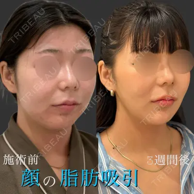 RIVER CLINIC（リバークリニック） 戸田 貴之医師の症例