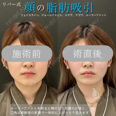 RIVER CLINIC（リバークリニック） 戸田 貴之医師の症例