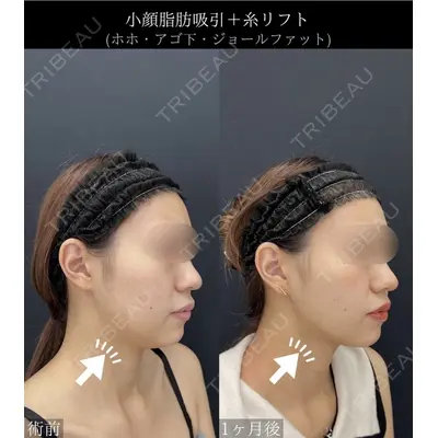 湘南美容クリニック 川崎院の症例