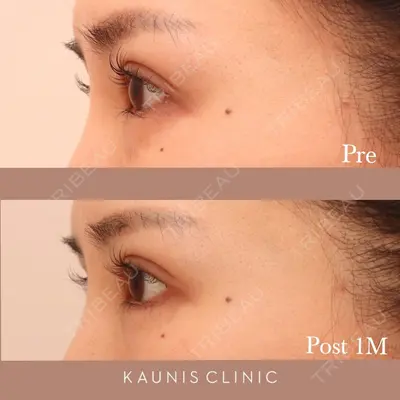 KAUNIS CLINIC（カウニスクリニック） 高野 敏郎医師の症例