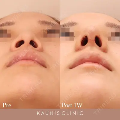 KAUNIS CLINIC（カウニスクリニック） 高野 敏郎医師の症例
